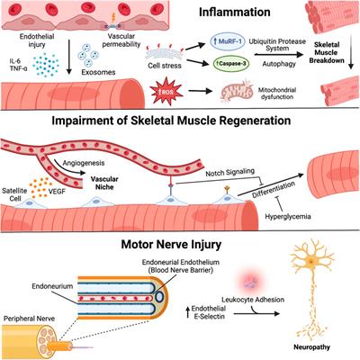The role of the microcirculation and integrative cardiovascular physiology in the pathogenesis of ICU-acquired weakness